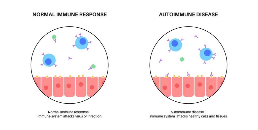 Autoimmune disease