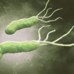 10 Medical Conditions Linked to H. Pylori
