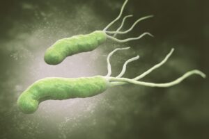 H pylori infection