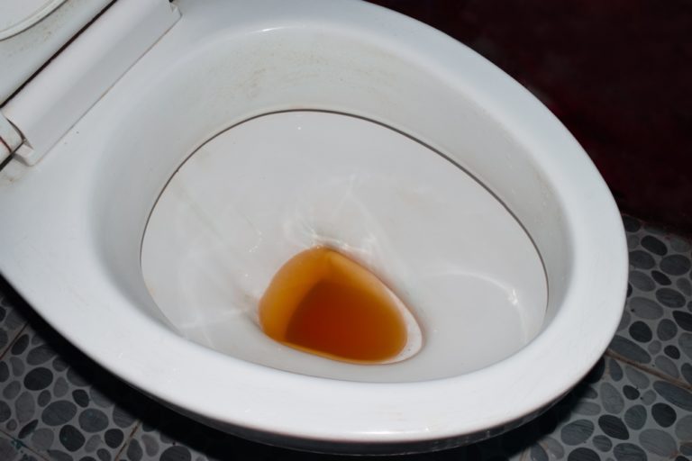 What Color is Your Pee? Suzy Cohen, RPh offers natural remedies to