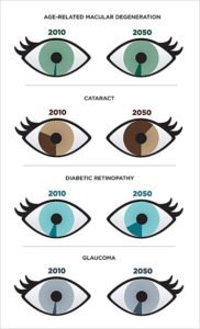 Eye Infographic