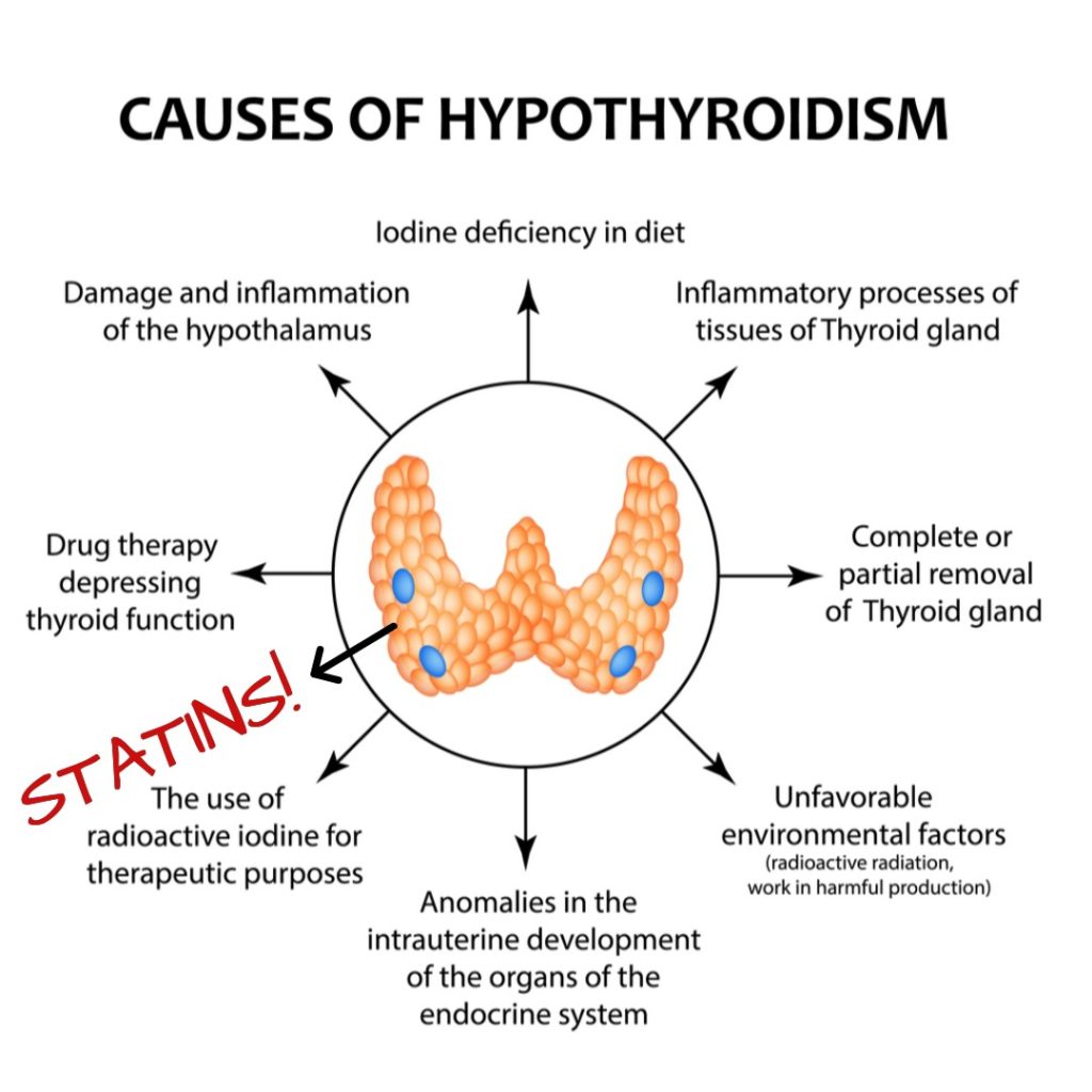 Thyroid Statins