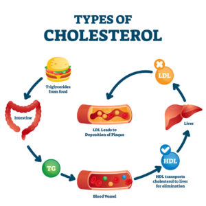 types of cholesterol