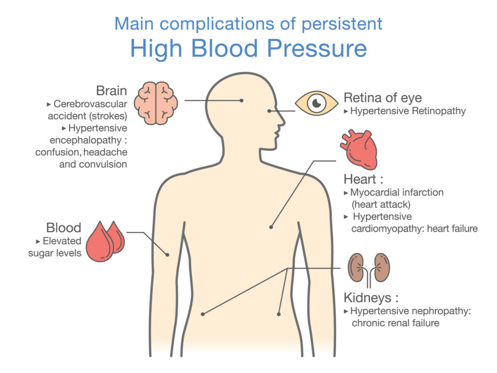 Complications of High Blood Pressure