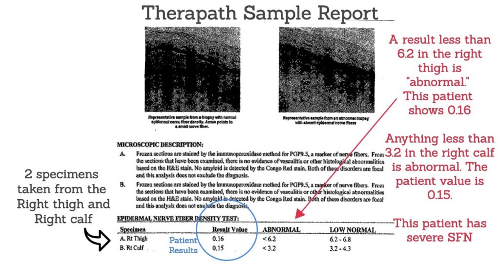 Therapath SFN results