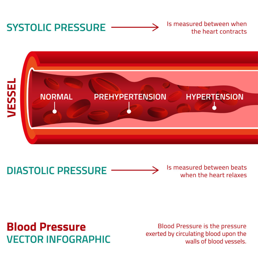 Diastolic and Systolic High Blood Pressure Measurements and Calcium Channel Blockers