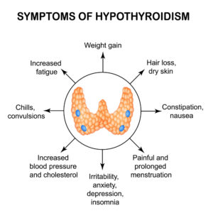 Symptoms of hypothyroidism. thyroid