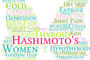 Hashimotos Thyroiditis