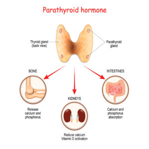 Parathyroid glands impact hair loss