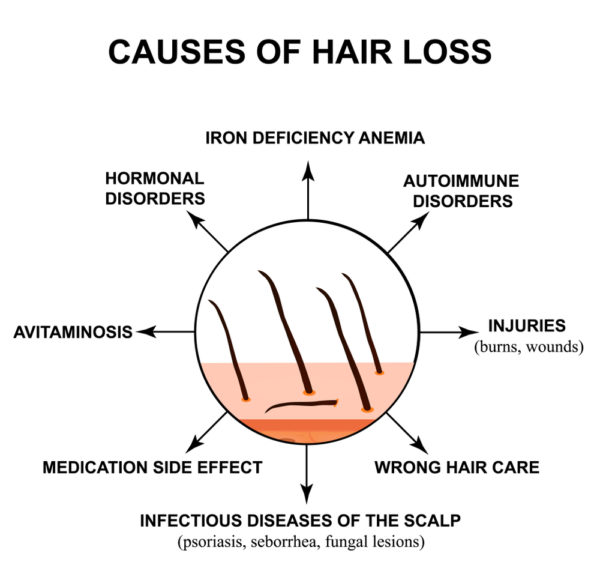 6 Common But Overlooked Causes for Unexpected Hair Loss Suzy Cohen