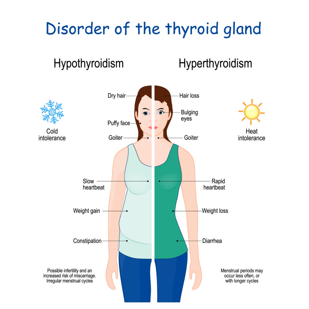 hypothyroidism and thyroid