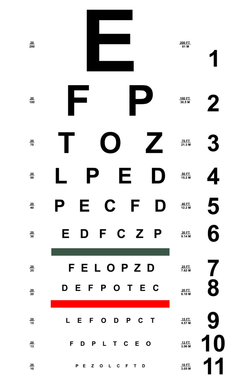 Eye Drops and 8 Natural Treatments for Blurry Vision Suzy Cohen, RPh