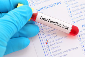 liver function tests are a way to protect your liver