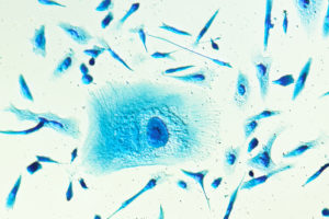 PC-3 human prostate cancer cells, stained with Coomassie blue