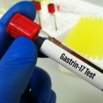The 3 Surprising Reasons Gastrin Should Be Measured