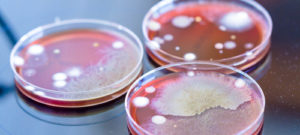 Petri dish with microbes
