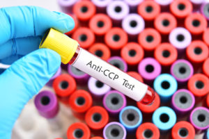 Anti-CCP rheumatoid test