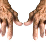 5 Natural Strategies for Rheumatoid Arthritis Pain