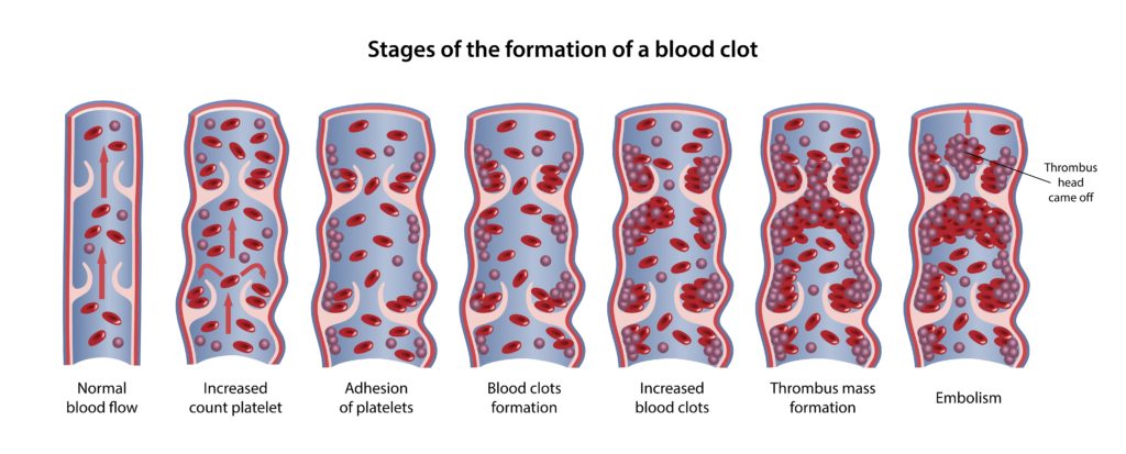Stages of Clot