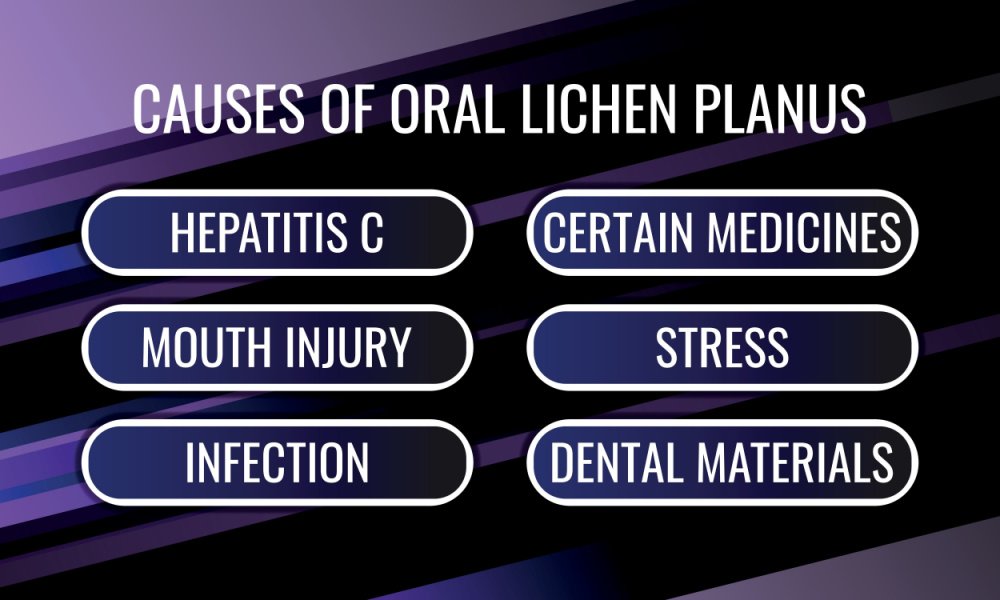 causes of oral lichen planus
