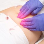 Thyroid and Fibroids: Unveiling the Link and 14 Natural Remedies