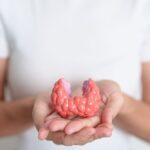 Iodine and Thyroid Nodules: 5 Intelligent Strategies for Management