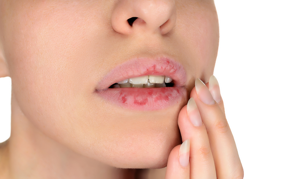 Image of woman skin picking her lips which is face touching