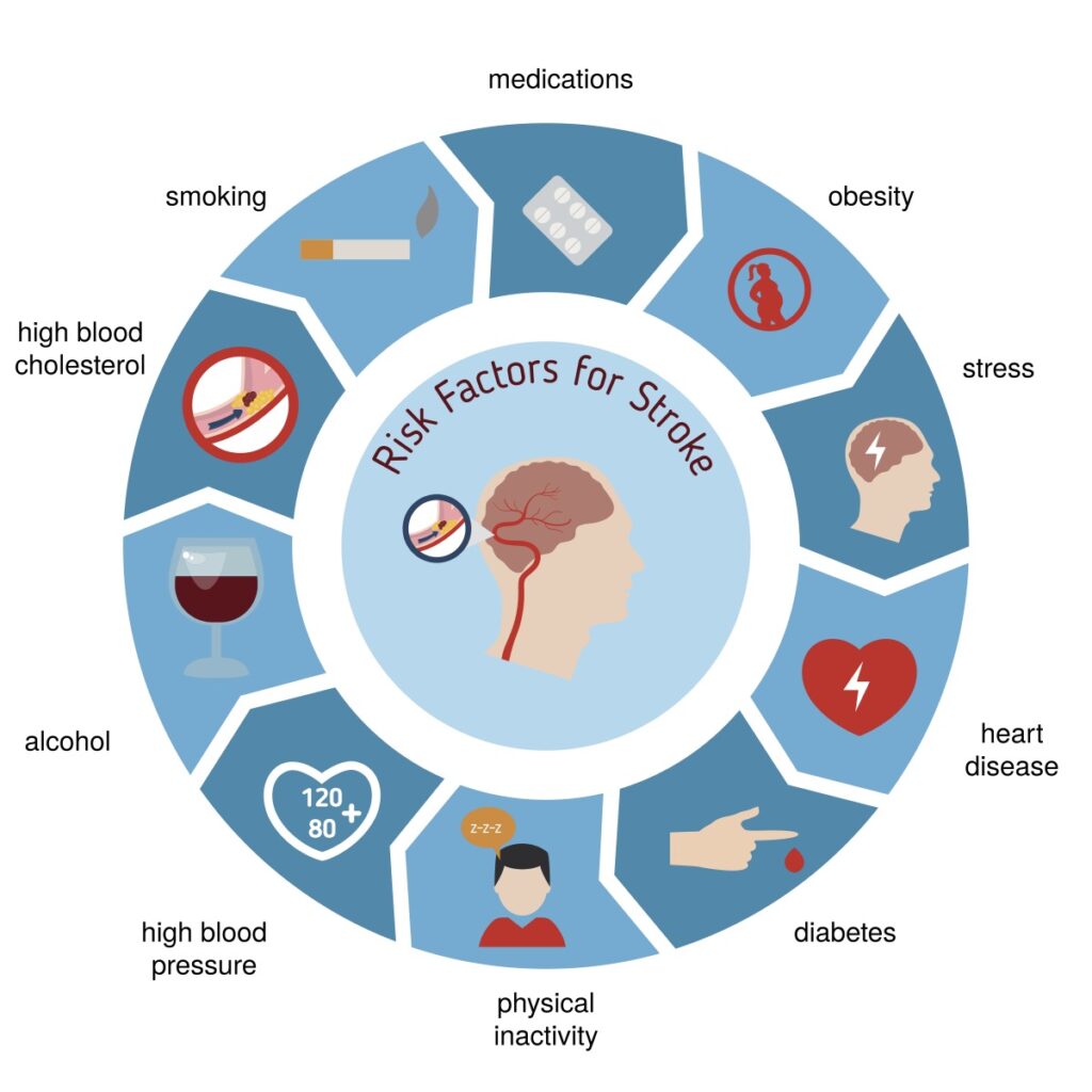 Image of stroke risk factors