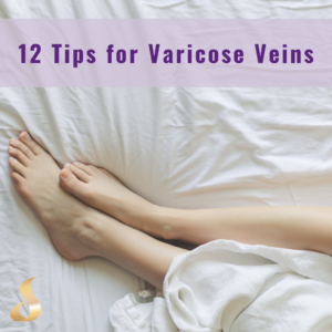 article link for 12 tips for varicose veins showing legs 