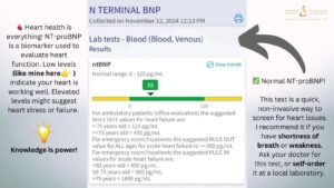 Image of a ProBNP lab test