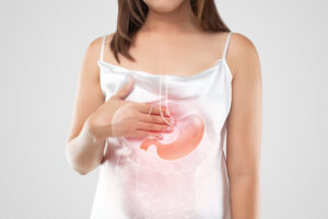 barretts esophagus