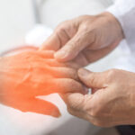 Soothing Small Fiber Neuropathy: 11 Natural and Prescription Sodium Channel Blockers