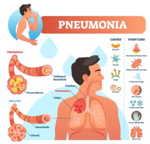 pneumoniasymptoms