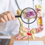 Bloating, Gas, and Gut Reactions: Choosing the Right Digestive Enzymes and Probiotics