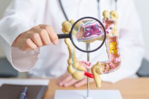 Articles by Suzy Cohen, America’s Pharmacist® 43 Digestive Enzymes Probiotics
