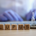 Understanding Lupus: Diagnostic Tools, Treatments, Peptides & Supplements