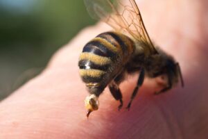 Bee stinging someone