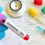 Your Cholesterol Number Isn’t the Whole Story: 7 Tests That Tell You More