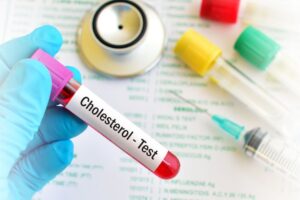 A gloved hand holding a tube of blood labeled "cholesterol"