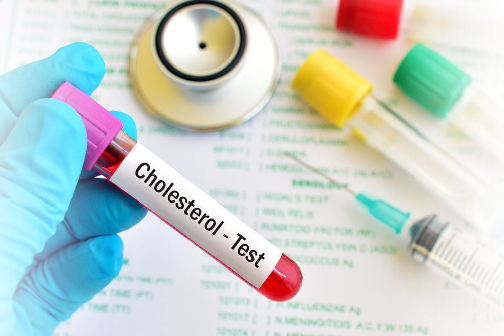 Read more about the article Your Cholesterol Number Isn’t the Whole Story: 7 Tests That Tell You More