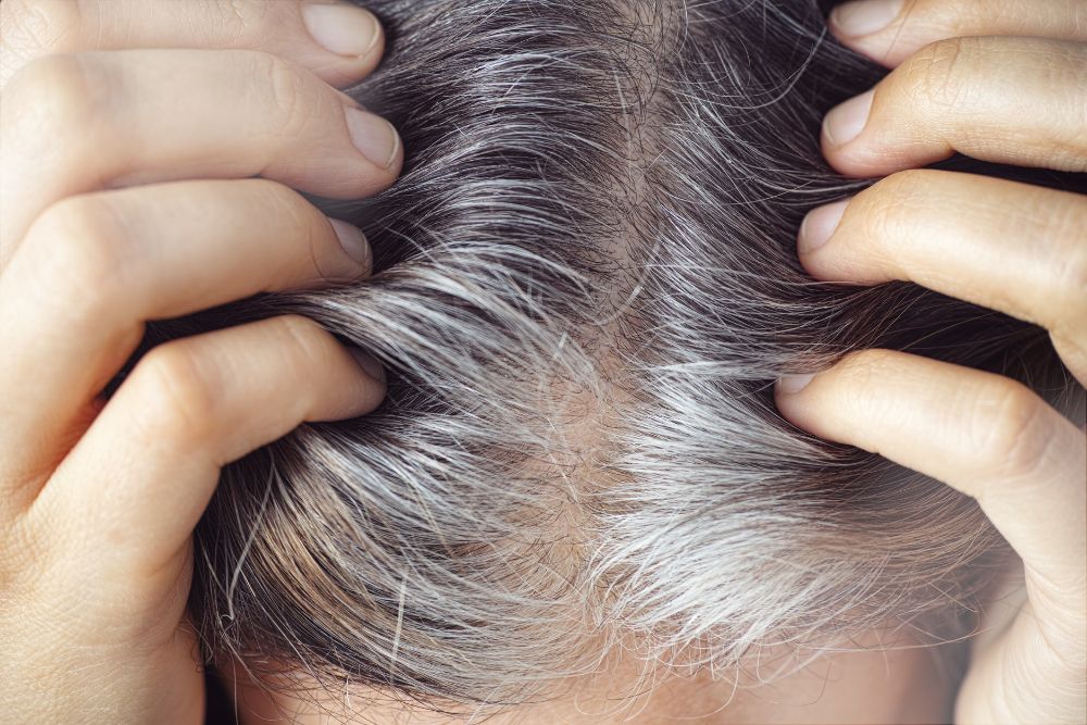 Read more about the article Why Hair Turns Gray: Catalase, Hydrogen Peroxide, and the Science of Hair Color